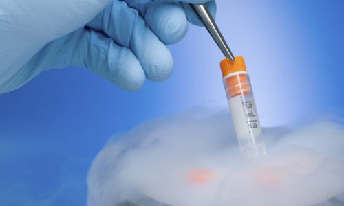 Egg freezing: Making babies in the modern world