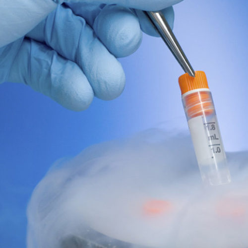 Egg freezing: Making babies in the modern world