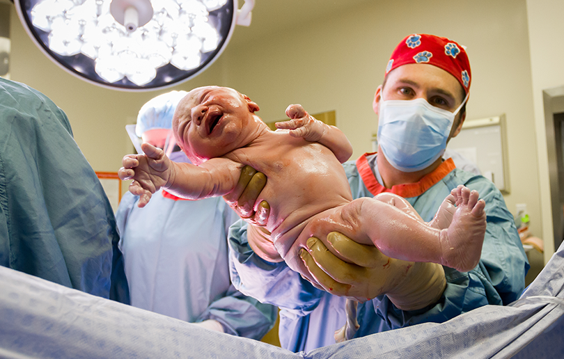 Natural cesarean