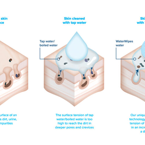 What makes WaterWipes the world’s purest baby wipes?